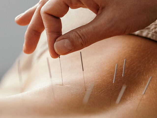 Licensed Acupuncturist
